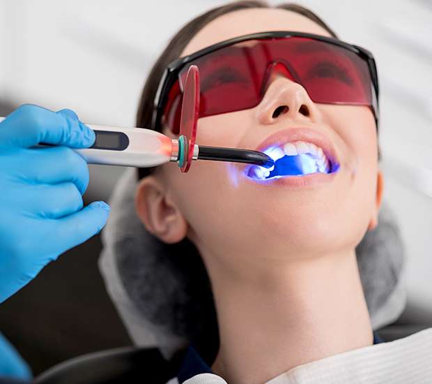 West Linn Professional Teeth Whitening