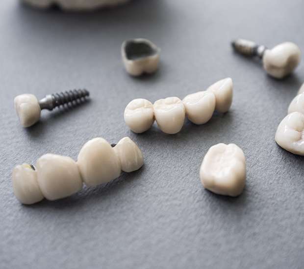 West Linn The Difference Between Dental Implants and Mini Dental Implants
